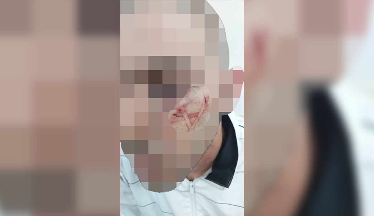 �srail Hitler'in izinde! Filistinli gencin y�z�n� 'Davud Y�ld�z�' �izerek kaz�d�lar