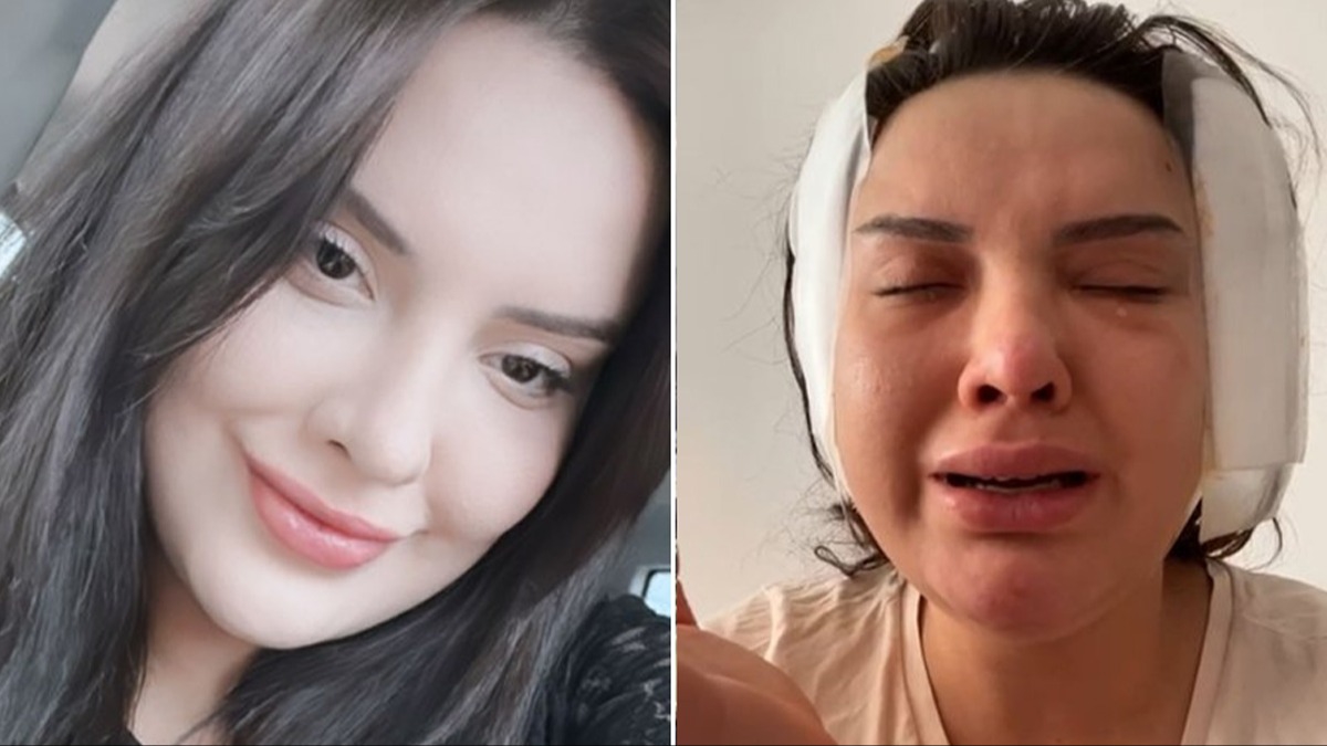 'Badem göz' ameliyatı bu hale getirdi!