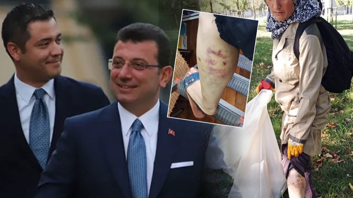 Murat Ongun'un kpei belediye alann yaralad! ikayeti olan ii iten kovuldu