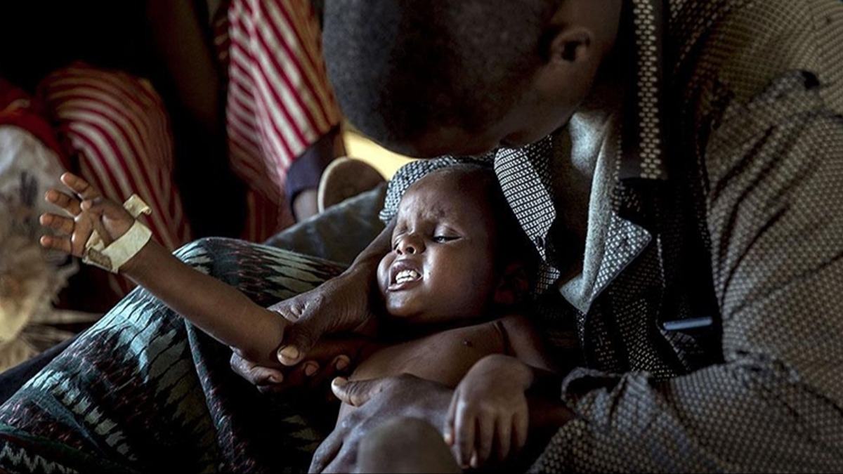 Zimbabve'de kolera can almaya devam ediyor! Ölenlerin sayısı 100'ü aştı