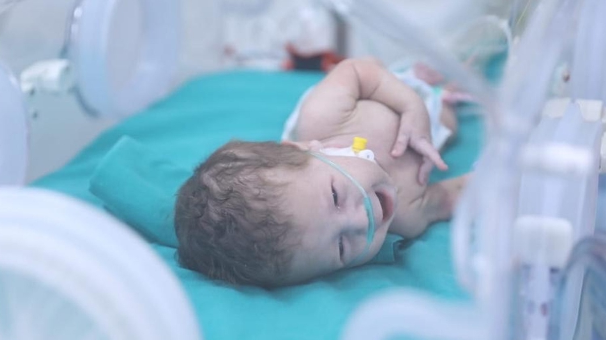 Gazze'deki bebeklere ''nefes'' ans: Prematre bebekler Msr'da 
