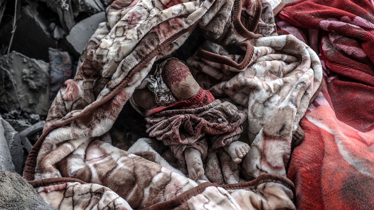 srailli hak rgt B'tselem: Gazze'de insani felaket inanlmaz ktleiyor 