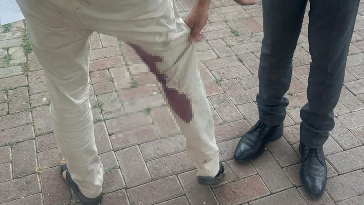 �anl�urfa'da kuduz deh�eti! Karantinaya al�nd� 